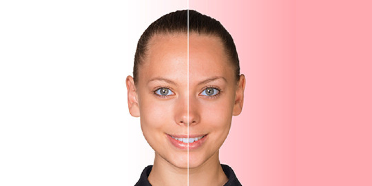 20 Ways to Lighten the Skin Tone – Expert Advice from a Dermatologist in Delhi