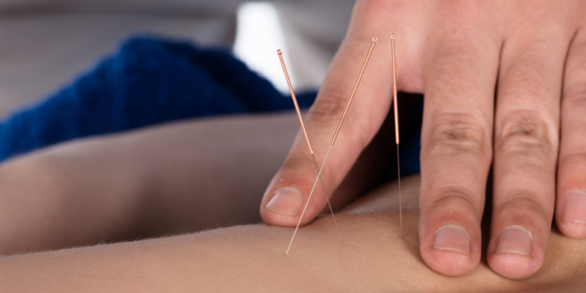 Recover Faster and Perform Better: Expert Physio Support in Malvern