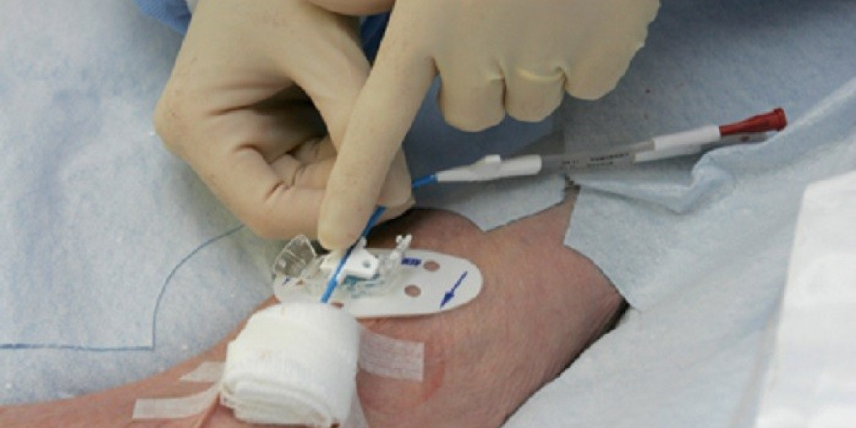 Vascular Access Devices Market Growth and Recent Trends by 2030