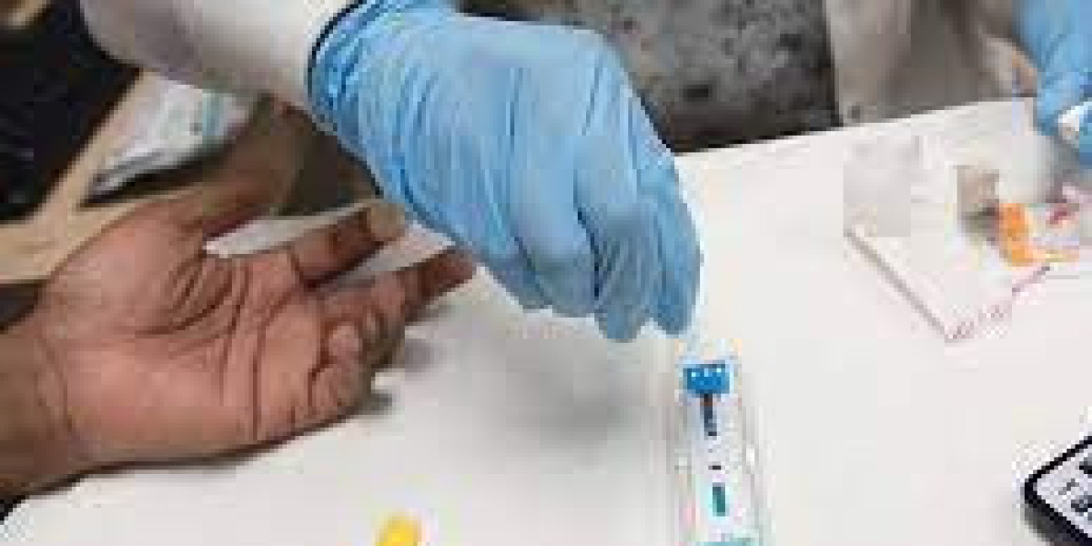 Protect Your Health with Free HIV Screening Services
