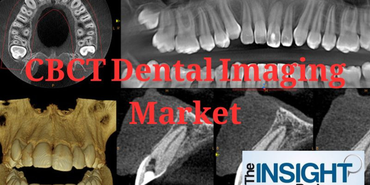 Global CBCT Dental Imaging Market Forecast to Expand Rapidly by 2030
