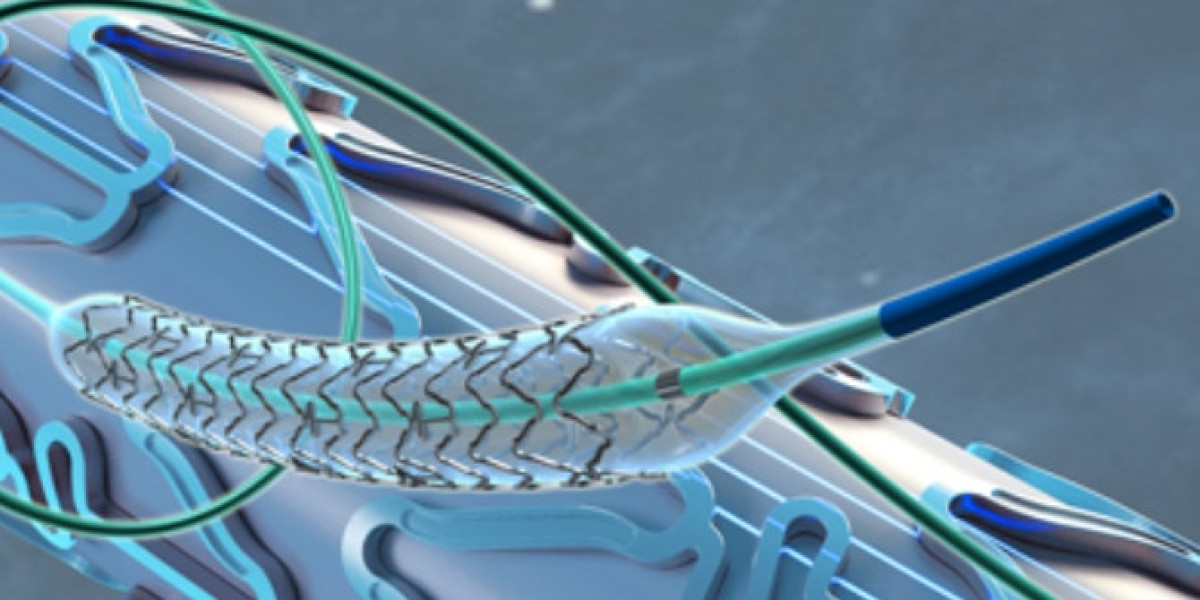 Neurovascular Devices Market: Empowering Stroke & Aneurysm Care