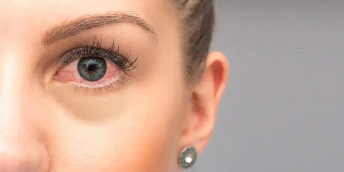 When Vision Slips Away: Expert Care for Retinal Detachment and Macular Holes