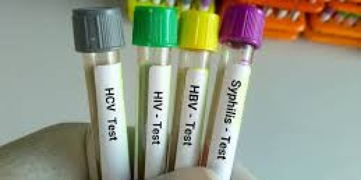 Free Testing Options in Fort Lauderdale