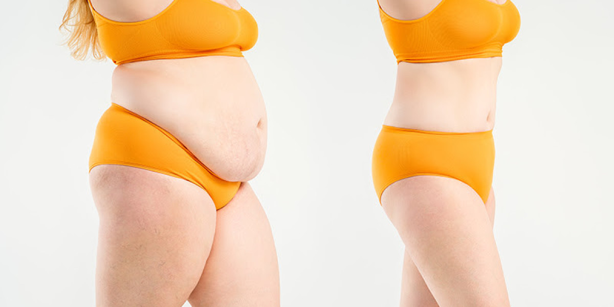 Buy GLP-1 Weight Loss Injections Online in USA | Semaglutide, Tirzepatide & Phentermine