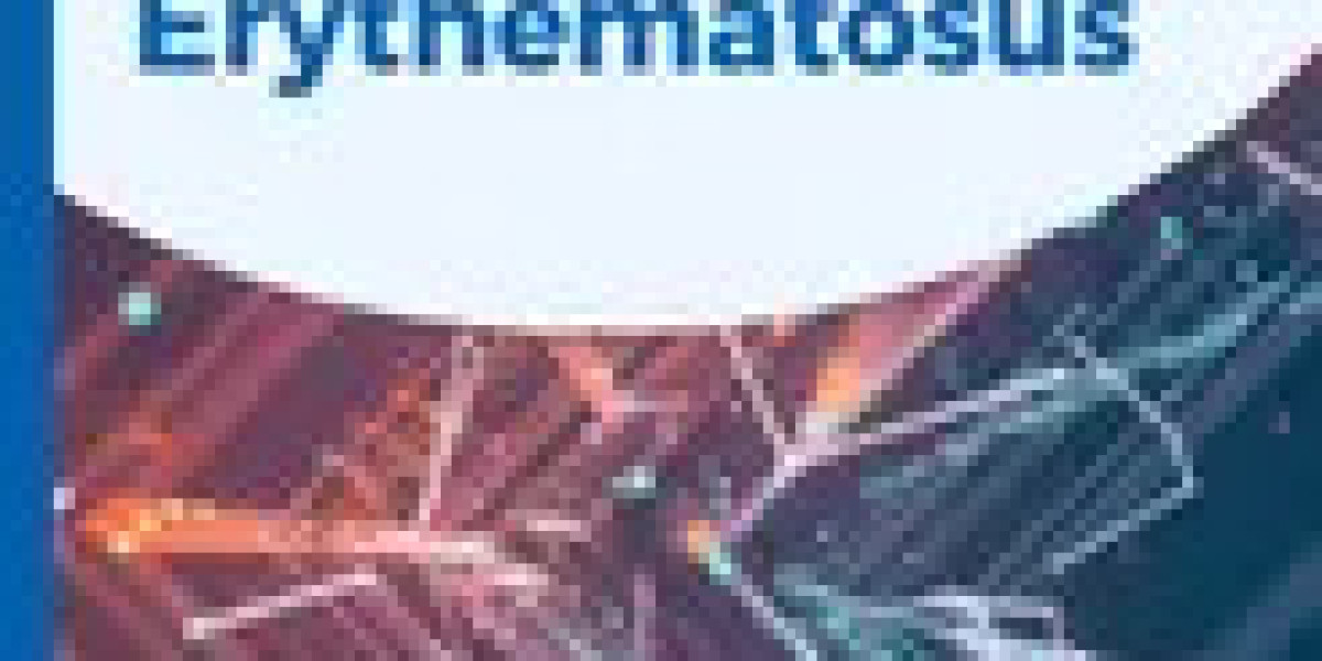 DelveInsight Comprehensive Report on Systemic Lupus Erythematosus Market