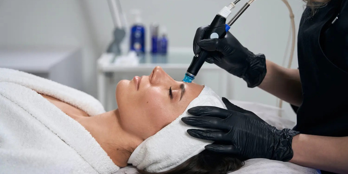 Chemical Peel: The Glow Up You Need